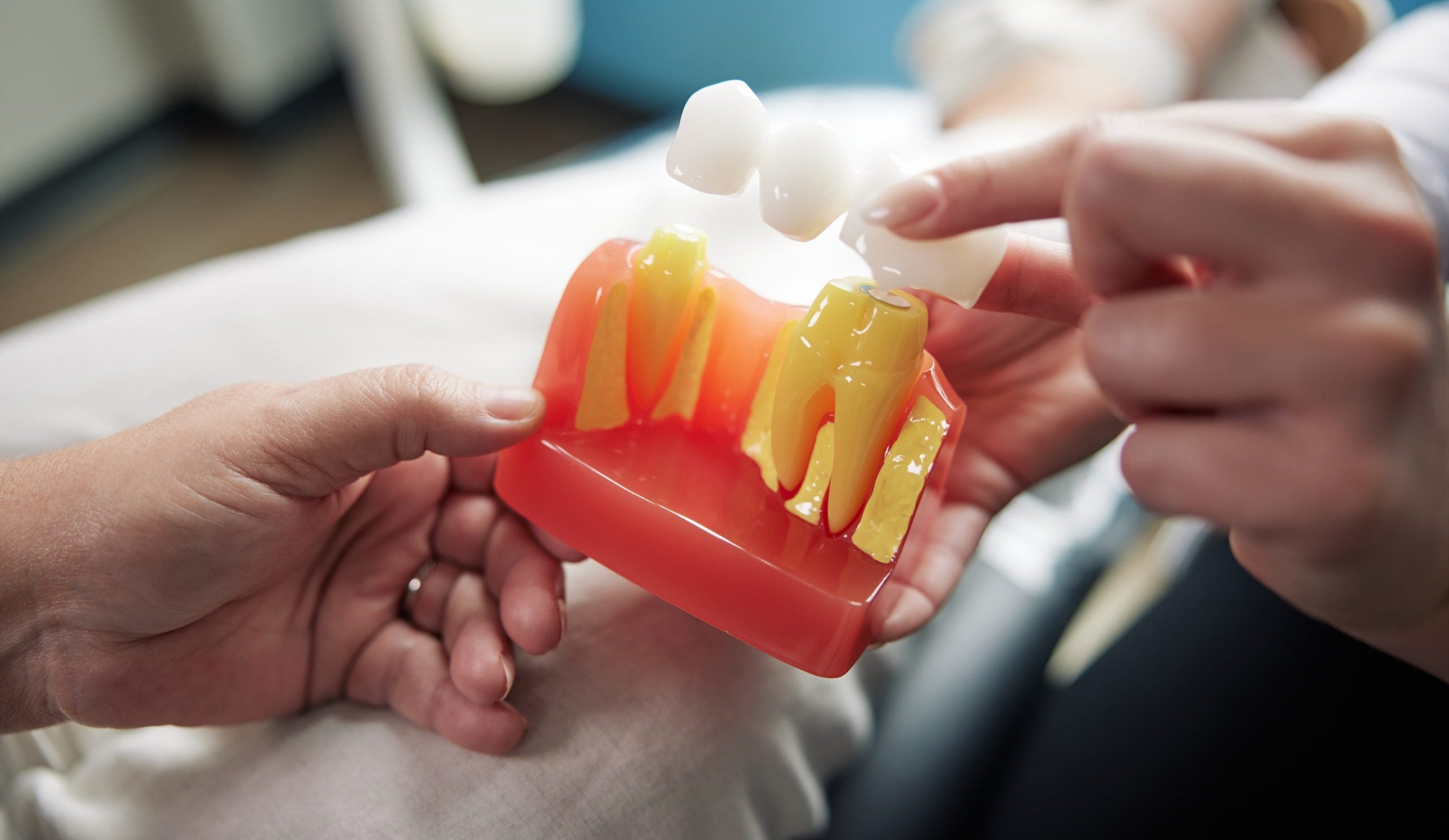 Doctor showing a patient how a dental bridge works